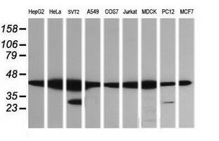 MAP2K1 / MKK1 / MEK1 Antibody - Western blot of extracts (35 ug) from 9 different cell lines by using anti-MAP2K1 monoclonal antibody (HepG2: human; HeLa: human; SVT2: mouse; A549: human; COS7: monkey; Jurkat: human; MDCK: canine; PC12: rat; MCF7: human).