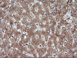 MAP2K1 / MKK1 / MEK1 Antibody - IHC of paraffin-embedded Human liver tissue using anti-MAP2K1 mouse monoclonal antibody.