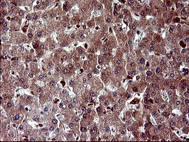 MAP2K1 / MKK1 / MEK1 Antibody - IHC of paraffin-embedded Human liver tissue using anti-MAP2K1 mouse monoclonal antibody. (Heat-induced epitope retrieval by 10mM citric buffer, pH6.0, 120°C for 3min).