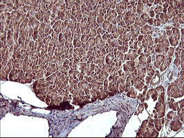 MAP2K1 / MKK1 / MEK1 Antibody - IHC of paraffin-embedded Human pancreas tissue using anti-MAP2K1 mouse monoclonal antibody. (Heat-induced epitope retrieval by 10mM citric buffer, pH6.0, 120°C for 3min).