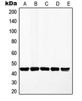 MAP2K1 / MKK1 / MEK1 Antibody - Western blot analysis of MKK1 expression in HeLa (A); A549 (B); MCF7 (C); HepG2 (D); PC12 (E) whole cell lysates.