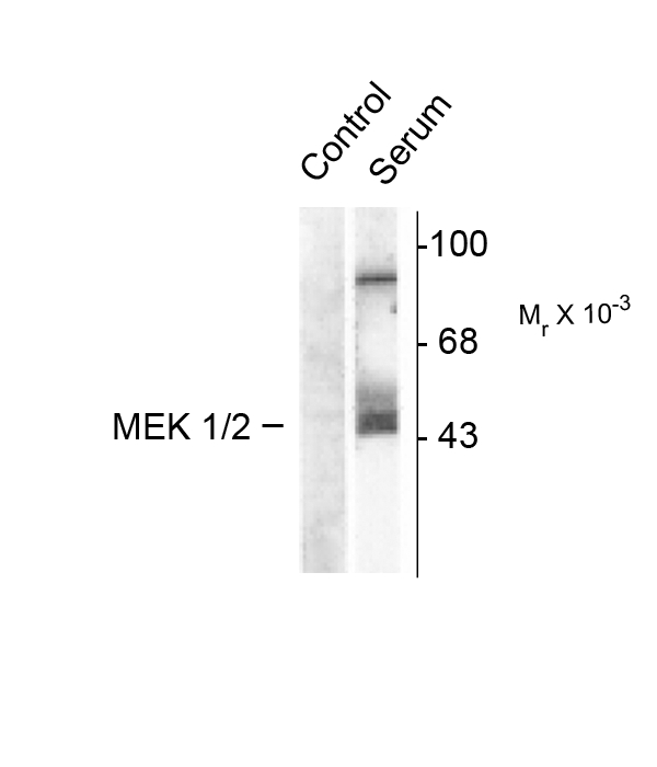 MAP2K1 / MKK1 / MEK1 Antibody - Western blot of NIH 3T3 cell lysates showing specific immunolabeling of the ~45k MEK 1/2 protein phosphorylated at Ser218 and Ser222. The cells were either serum starved (Control) or incubated in the presence of serum (Serum). Immunolabeling of an additional band at ~95k was also observed.