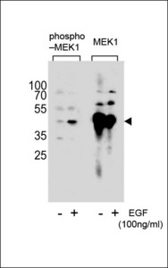 MAP2K1 / MKK1 / MEK1 Antibody - Western blot of extracts from A431 cell,untreated or treated with EGF, 100ng/ml,using Phospho-MEK1-pS222(left) or MEK1-pS222 antibody(right).