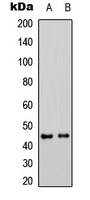 MAP2K1 / MKK1 / MEK1 Antibody - Western blot analysis of MKK1 (pS298) expression in HepG2-UV (A); NIH3T3 (B) whole cell lysates.