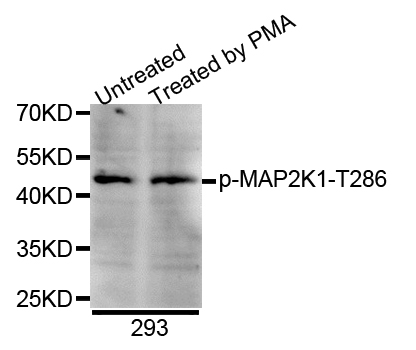 MAP2K1 / MKK1 / MEK1 Antibody - Western blot analysis of extracts of 293 cells.