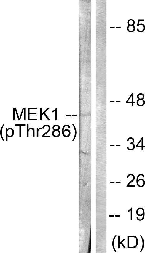 MAP2K1 / MKK1 / MEK1 Antibody - Western blot analysis of lysates from K562 cells, using MEK1 (Phospho-Thr286) Antibody. The lane on the right is blocked with the phospho peptide.