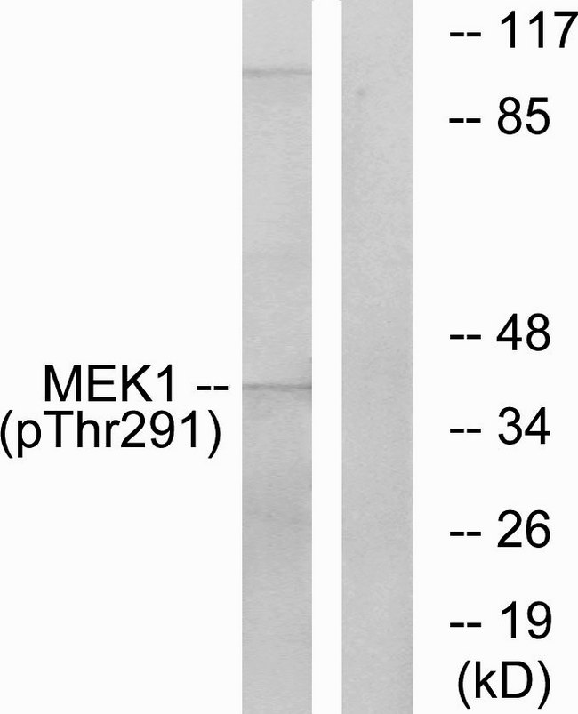 MAP2K1 / MKK1 / MEK1 Antibody - Western blot analysis of lysates from K562 cells, using MEK1 (Phospho-Thr291) Antibody. The lane on the right is blocked with the phospho peptide.