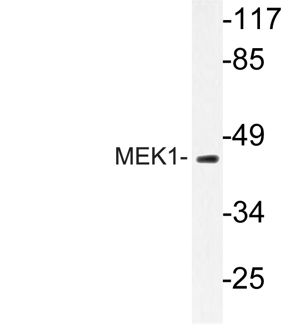 MAP2K1 / MKK1 / MEK1 Antibody - Western blot of MEK1 (T286) pAb in extracts from Jurkat cells.