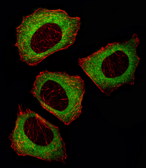 MAP2K2 / MKK2 / MEK2 Antibody - Fluorescent image of U251 cell stained with MEK2 (MAP2K2) Antibody. U251 cells were fixed with 4% PFA (20 min), permeabilized with Triton X-100 (0.1%, 10 min), then incubated with MEK2 primary antibody (1:25, 1 h at 37°C). For secondary antibody, Alexa Fluor 488 conjugated donkey anti-rabbit antibody (green) was used (1:400, 50 min at 37°C). Cytoplasmic actin was counterstained with Alexa Fluor 555 (red) conjugated Phalloidin (7units/ml, 1 h at 37°C). MEK2 immunoreactivity is localized to Cytoplasm significantly.