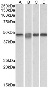 MAP2K2 / MKK2 / MEK2 Antibody - MAP2K2 antibody (0.3 ug/ml) staining of Daudi (A), Jurkat (B), K562 (C) and Molt4 (D) lysates (35 ug protein in RIPA buffer). Primary incubation was 1 hour. Detected by chemiluminescence.
