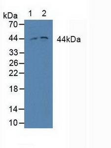 MAP2K2 / MKK2 / MEK2 Antibody - Western Blot; Sample: Lane1: Human Jurkat cells; Lane2: Human Hela cels.