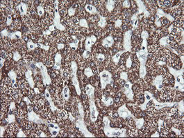 MAP2K2 / MKK2 / MEK2 Antibody - IHC of paraffin-embedded Human liver tissue using anti-MAP2K2 mouse monoclonal antibody. (Heat-induced epitope retrieval by 10mM citric buffer, pH6.0, 120°C for 3min).