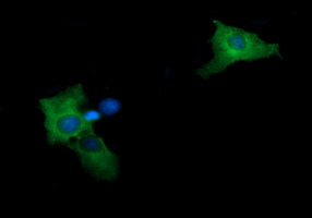MAP2K2 / MKK2 / MEK2 Antibody - Anti-MAP2K2 mouse monoclonal antibody immunofluorescent staining of COS7 cells transiently transfected by pCMV6-ENTRY MAP2K2.