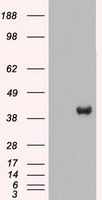MAP2K2 / MKK2 / MEK2 Antibody - HEK293T cells were transfected with the pCMV6-ENTRY control (Left lane) or pCMV6-ENTRY MAP2K2 (Right lane) cDNA for 48 hrs and lysed. Equivalent amounts of cell lysates (5 ug per lane) were separated by SDS-PAGE and immunoblotted with anti-MAP2K2.