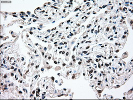 MAP2K2 / MKK2 / MEK2 Antibody - IHC of paraffin-embedded lung tissue using anti-MAP2K2 mouse monoclonal antibody. (Dilution 1:50).
