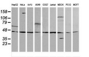 MAP2K2 / MKK2 / MEK2 Antibody - Western blot of extracts (35ug) from 9 different cell lines by using anti-MAP2K2 monoclonal antibody (HepG2: human; HeLa: human; SVT2: mouse; A549: human; COS7: monkey; Jurkat: human; MDCK: canine; PC12: rat; MCF7: human).