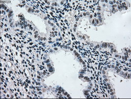 MAP2K2 / MKK2 / MEK2 Antibody - IHC of paraffin-embedded endometrium tissue using anti-MAP2K2 mouse monoclonal antibody. (Dilution 1:50).