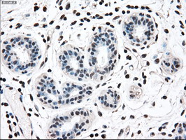 MAP2K2 / MKK2 / MEK2 Antibody - IHC of paraffin-embedded breast tissue using anti-MAP2K2 mouse monoclonal antibody. (Dilution 1:50).