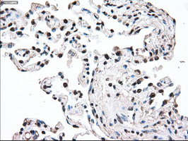 MAP2K2 / MKK2 / MEK2 Antibody - IHC of paraffin-embedded lung tissue using anti-MAP2K2 mouse monoclonal antibody. (Dilution 1:50).