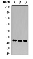 MAP2K2 / MKK2 / MEK2 Antibody - Western blot analysis of MKK2 expression in HeLa (A); NIH3T3 (B); rat brain (C) whole cell lysates.