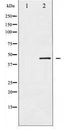 MAP2K2 / MKK2 / MEK2 Antibody - Western blot of MEK2 expression in ovary cancer whole cell lysates,The lane on the left is treated with the antigen-specific peptide.
