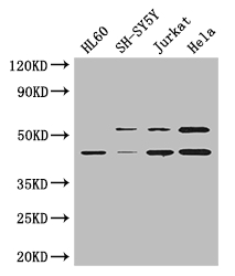 MAP2K2 / MKK2 / MEK2 Antibody - Positive WB detected in:HL60 whole cell lysate,SH-SY5Y whole cell lysate,Jurkat whole cell lysate,Hela whole cell lysate;All lanes: MAP2K2 antibody at 2.8ug/ml;Secondary;Goat polyclonal to rabbit IgG at 1/50000 dilution;Predicted band size: 45 kDa;Observed band size: 45,55 kDa;