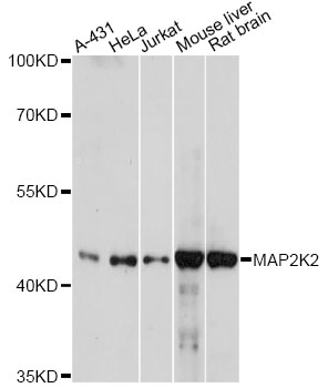 MAP2K2 / MKK2 / MEK2 Antibody - Western blot analysis of extracts of various cell lines, using MAP2K2 antibody at 1:1000 dilution. The secondary antibody used was an HRP Goat Anti-Rabbit IgG (H+L) at 1:10000 dilution. Lysates were loaded 25ug per lane and 3% nonfat dry milk in TBST was used for blocking. An ECL Kit was used for detection and the exposure time was 10s.
