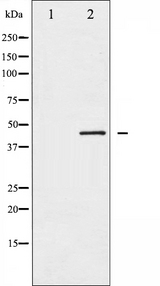 MAP2K2 / MKK2 / MEK2 Antibody - Western blot analysis of MEK2 expression in ovarycarcinoma whole cells lysates. The lane on the left is treated with the antigen-specific peptide.