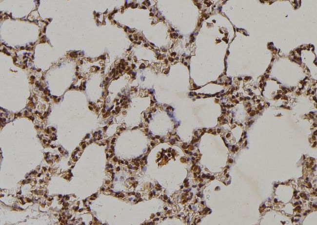 MAP2K2 / MKK2 / MEK2 Antibody - 1:100 staining rat lung tissue by IHC-P. The sample was formaldehyde fixed and a heat mediated antigen retrieval step in citrate buffer was performed. The sample was then blocked and incubated with the antibody for 1.5 hours at 22°C. An HRP conjugated goat anti-rabbit antibody was used as the secondary.