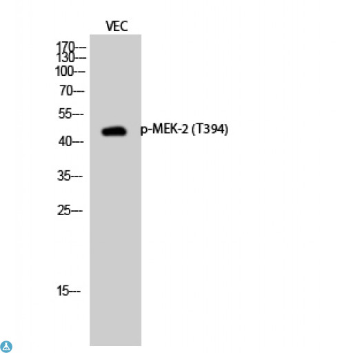 MAP2K2 / MKK2 / MEK2 Antibody - Western Blot (WB) analysis of VEC cells using Phospho-MEK-2 (T394) polyclonal antibody.