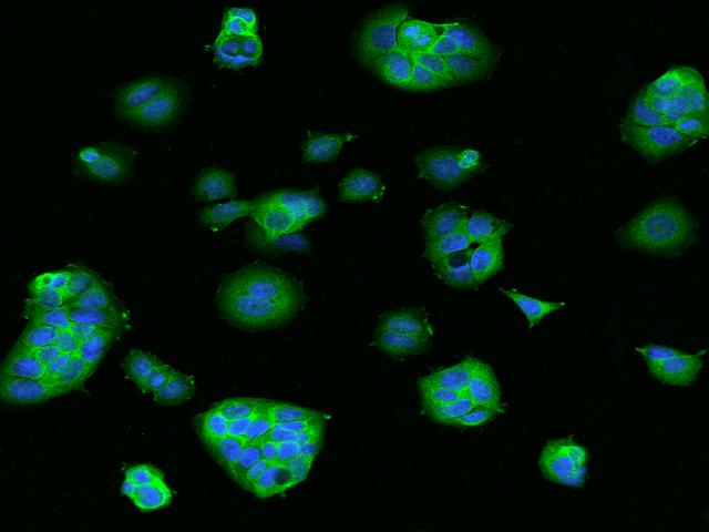 MAP2K2 / MKK2 / MEK2 Antibody - Immunofluorescence staining of MAP2K2 in MCF7 cells. Cells were fixed with 4% PFA, permeabilzed with 0.1% Triton X-100 in PBS, blocked with 10% serum, and incubated with rabbit anti-Human MAP2K2 polyclonal antibody (dilution ratio 1:200) at 4°C overnight. Then cells were stained with the Alexa Fluor 488-conjugated Goat Anti-rabbit IgG secondary antibody (green) and counterstained with DAPI (blue). Positive staining was localized to Cytoplasm.