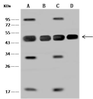 MAP2K2 / MKK2 / MEK2 Antibody - Anti-MAP2K2 rabbit polyclonal antibody at 1:2000 dilution. Lane A: Jurkat Whole Cell Lysate. Lane B: HepG2 Whole Cell Lysate. Lane C: HeLa Whole Cell Lysate. Lane D: A549 Whole Cell Lysate. Lysates/proteins at 30 ug per lane. Secondary: Goat Anti-Rabbit IgG (H+L)/HRP at 1/10000 dilution. Developed using the ECL technique. Performed under reducing conditions. Predicted band size: 44 kDa. Observed band size: 44 kDa. (We are unsure as to the identity of these extra bands.)