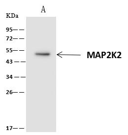 MAP2K2 / MKK2 / MEK2 Antibody - MAP2K2 was immunoprecipitated using: Lane A: 0.5 mg Jurkat Whole Cell Lysate. 4 uL anti-MAP2K2 rabbit polyclonal antibody and 60 ug of Immunomagnetic beads Protein A/G. Primary antibody: Anti-MAP2K2 rabbit polyclonal antibody, at 1:100 dilution. Secondary antibody: Clean-Blot IP Detection Reagent (HRP) at 1:1000 dilution. Developed using the ECL technique. Performed under reducing conditions. Predicted band size: 44 kDa. Observed band size: 47 kDa.