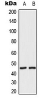 MAP2K2 / MKK2 / MEK2 Antibody - Western blot analysis of MKK2 (pT394) expression in HeLa UV-treated (A); HepG2 UV-treated (B) whole cell lysates.
