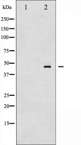 MAP2K2 / MKK2 / MEK2 Antibody - Western blot analysis of MEK2 phosphorylation expression in ovary carcinoma whole cells lysates. The lane on the left is treated with the antigen-specific peptide.