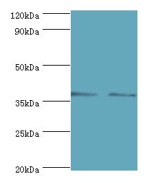MAP2K3 / MEK3 / MKK3 Antibody - Western blot. All lanes: MAP2K3 antibody at 7 ug/ml. Lane 1: MCF7 whole cell lysate. Lane 2: COLO320 whole cell lysate. Secondary antibody: Goat polyclonal to rabbit at 1:10000 dilution. Predicted band size: 39 kDa. Observed band size: 39 kDa Immunohistochemistry.