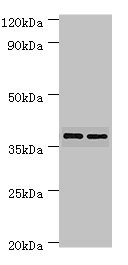 MAP2K3 / MEK3 / MKK3 Antibody - Western blot All lanes: MAP2K3 antibody at 7µg/ml Lane 1: MCF-7 whole cell lysate Lane 2: COLO320 whole cell lysate Secondary Goat polyclonal to rabbit IgG at 1/10000 dilution Predicted band size: 40, 37 kDa Observed band size: 40 kDa