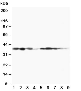 MAP2K3 / MEK3 / MKK3 Antibody - Western blot testing of MEK3 antibody and Lane 1: rat spleen; 2: rat thymus; 3: rat skeletal muscle; 4: rat kidney, and human samples 5: MCF-7; 6: HeLa; 7: Raji; 8: CEM; 9: COLO320 cell lysate