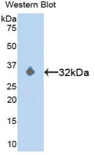 MAP2K3 / MEK3 / MKK3 Antibody - Western blot of recombinant MAP2K3 / MEK3 / MKK3.  This image was taken for the unconjugated form of this product. Other forms have not been tested.