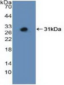 MAP2K3 / MEK3 / MKK3 Antibody - Western Blot; Sample: Recombinant MAP2K3, Human.