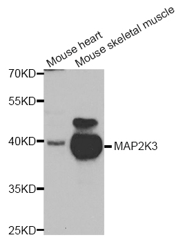 MAP2K3 / MEK3 / MKK3 Antibody - Western blot analysis of extracts of various cell lines.