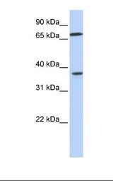 MAP2K3 / MEK3 / MKK3 Antibody - 721_B cell lysate. Antibody concentration: 1.0 ug/ml. Gel concentration: 12%.  This image was taken for the unconjugated form of this product. Other forms have not been tested.