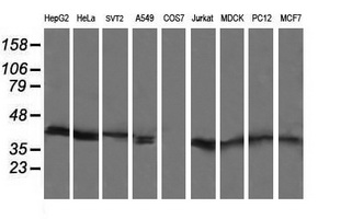 MAP2K3 / MEK3 / MKK3 Antibody - Western blot of extracts (35ug) from 9 different cell lines by using anti-MAP2K3 monoclonal antibody (HepG2: human; HeLa: human; SVT2: mouse; A549: human; COS7: monkey; Jurkat: human; MDCK: canine; PC12: rat; MCF7: human).