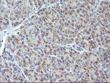 MAP2K3 / MEK3 / MKK3 Antibody - IHC of paraffin-embedded Human pancreas tissue using anti-MAP2K3 mouse monoclonal antibody. (Heat-induced epitope retrieval by 10mM citric buffer, pH6.0, 120°C for 3min).