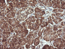 MAP2K3 / MEK3 / MKK3 Antibody - IHC of paraffin-embedded Human pancreas tissue using anti-MAP2K3 mouse monoclonal antibody.