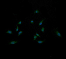 MAP2K3 / MEK3 / MKK3 Antibody - Immunofluorescent staining of HeLa cells using anti-MAP2K3 mouse monoclonal antibody.