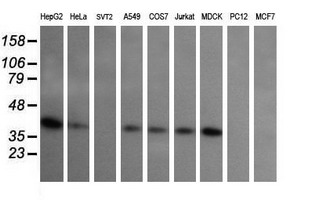 MAP2K3 / MEK3 / MKK3 Antibody - Western blot of extracts (35 ug) from 9 different cell lines by using g anti-MAP2K3 monoclonal antibody (HepG2: human; HeLa: human; SVT2: mouse; A549: human; COS7: monkey; Jurkat: human; MDCK: canine; PC12: rat; MCF7: human).