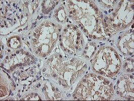 MAP2K3 / MEK3 / MKK3 Antibody - IHC of paraffin-embedded Human Kidney tissue using anti-MAP2K3 mouse monoclonal antibody.