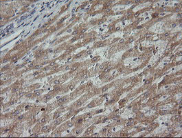 MAP2K3 / MEK3 / MKK3 Antibody - IHC of paraffin-embedded Human liver tissue using anti-MAP2K3 mouse monoclonal antibody.