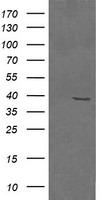 MAP2K3 / MEK3 / MKK3 Antibody - HEK293T cells were transfected with the pCMV6-ENTRY control (Left lane) or pCMV6-ENTRY MAP2K3 (Right lane) cDNA for 48 hrs and lysed. Equivalent amounts of cell lysates (5 ug per lane) were separated by SDS-PAGE and immunoblotted with anti-MAP2K3.